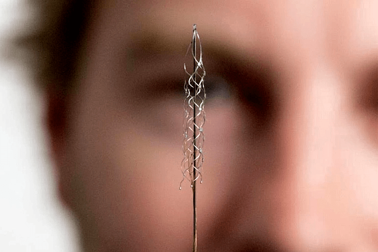 For the first time ever, a chip implanted in the brain allows a paralyzed man to tweet